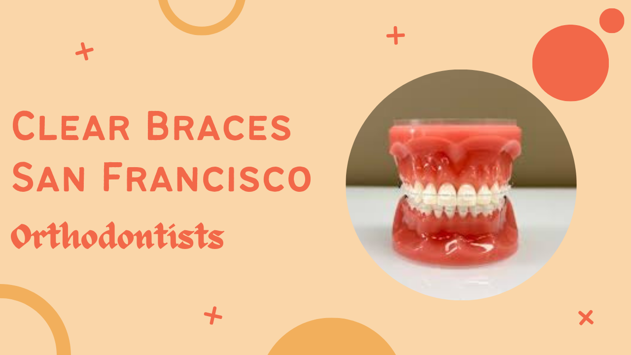 Elevating Your Smile with Clear Braces from San Francisco Orthodontists